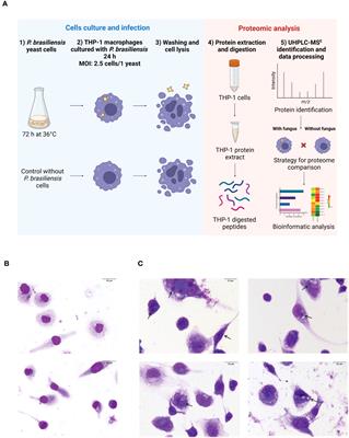 Proteomic analysis reveals changes in the proteome of human THP-1 macrophages infected with Paracoccidioides brasiliensis